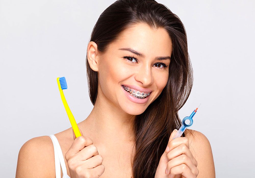 Чистка зубов с брекетами: ключевые шаги и рекомендации