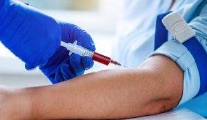 Цитомегаловирус (ЦМВ)