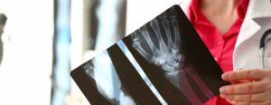 Стационарный vs. портативный рентген: сравнительный обзор в медицинской практике