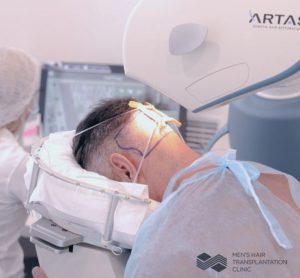 Як працює роботизована пересадка волосся FUE ARTAS у клініці MHT